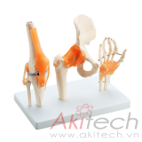 mô hình khớp gối khớp hông khớp bàn tay với dây chằng, mô hình bộ môn giải phẫu, mô hình giảng dạy, mô hình giảng dạy y khoa, CBM-103A, an kim, akitech