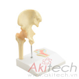 mô hình khớp hông với dây chằng và một phần mặt cắt thẳng đứng từ trái qua phải , mô hình bộ môn giải phẫu, mô hình giảng dạy, mô hình giảng dạy y khoa, CBM-103B, an kim, akitech