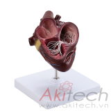 mô hình giun tròn trong tim, mô hình bộ môn giải phẫu, mô hình giảng dạy, mô hình giảng dạy y khoa, CBM-261E, an kim, akitech